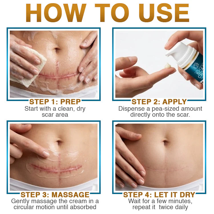 𝗖𝗮𝗿𝗲𝗕𝗿𝗲𝗲𝘇𝗲® 100% Silicone Scar Cream Formula 👨‍⚕️ - Image 8