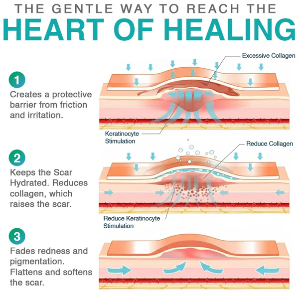𝗖𝗮𝗿𝗲𝗕𝗿𝗲𝗲𝘇𝗲® 3-in-1 Microneedle Care Patch - Image 10