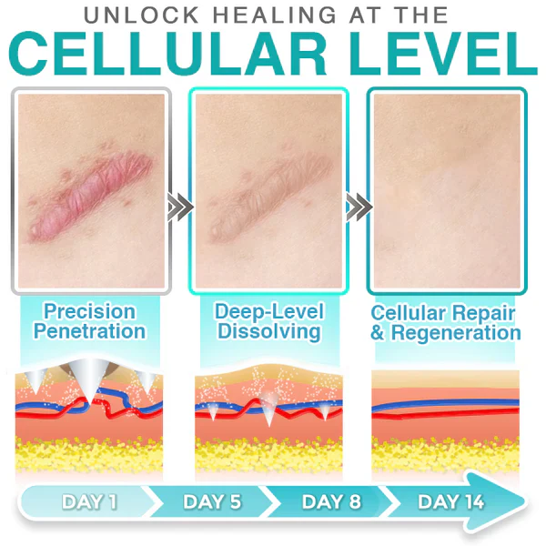 𝗖𝗮𝗿𝗲𝗕𝗿𝗲𝗲𝘇𝗲® 3-in-1 Microneedle Care Patch - Image 9