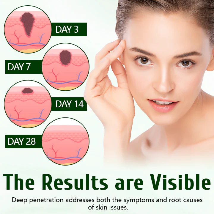 ✅ Timilk® Tea Tree Skin Healing Cream - Image 3