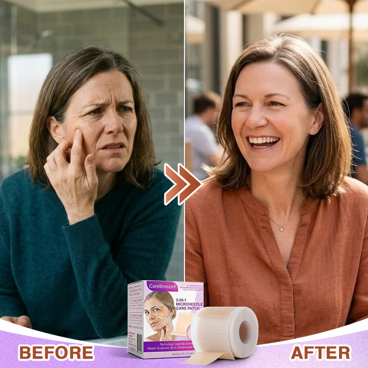 ๐พ๐๐ง๐๐ฝ๐ง๐๐๐ฏ๐ยฎ Microneedle Anti-Aging Care Patch - Image 11