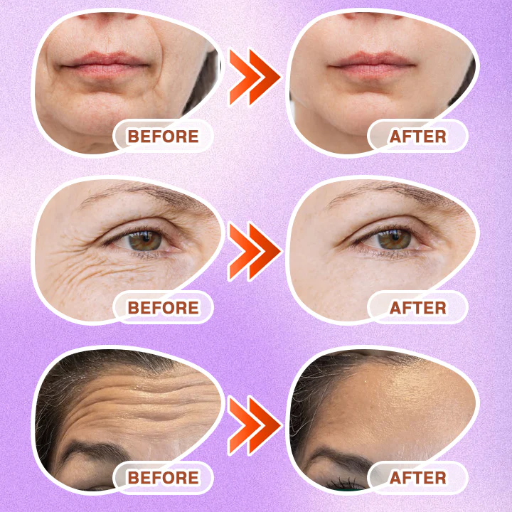 ๐พ๐๐ง๐๐ฝ๐ง๐๐๐ฏ๐ยฎ Microneedle Anti-Aging Care Patch - Image 4