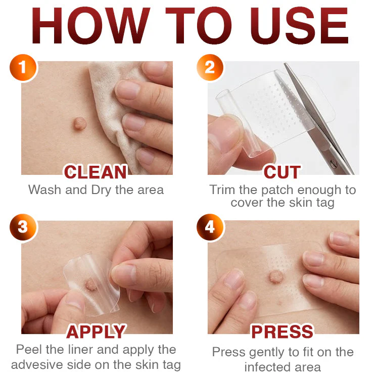 CareBreeze® Skin Tag Removal Micro-needle Patch - Image 10